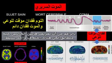 صورة قراءة النشاط الكهربائي للدماغ EEG في تعريف الموت والنوم وقياس أنشطة المخ والنشاط الفسيولوجي